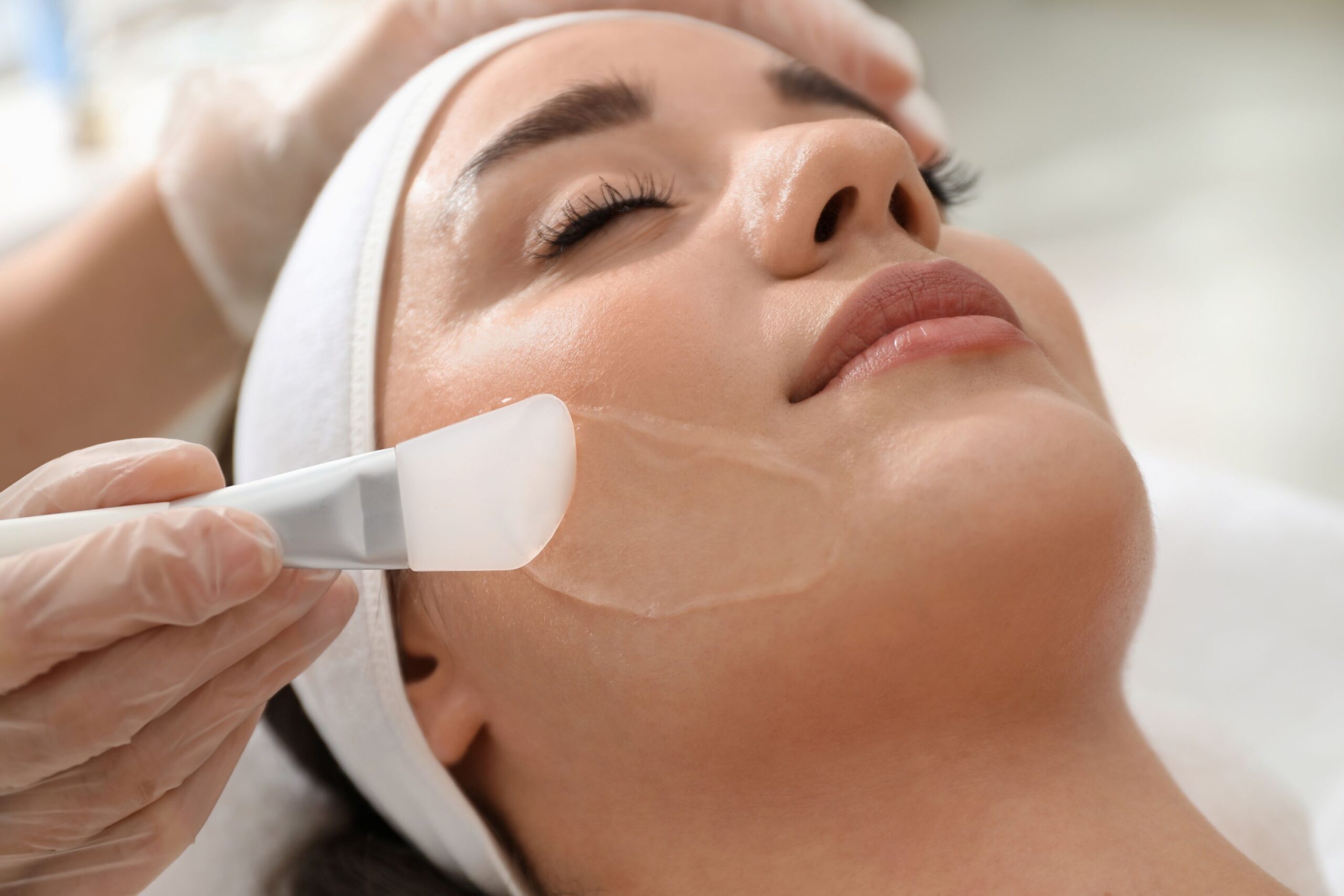 How Long Do Chemical Peels Last?