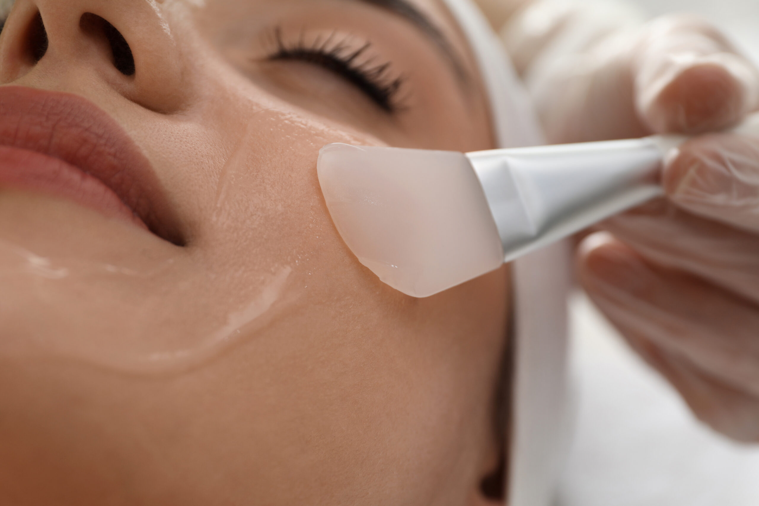Chemical Peels Risks and Safety: What Every Patient Should Know