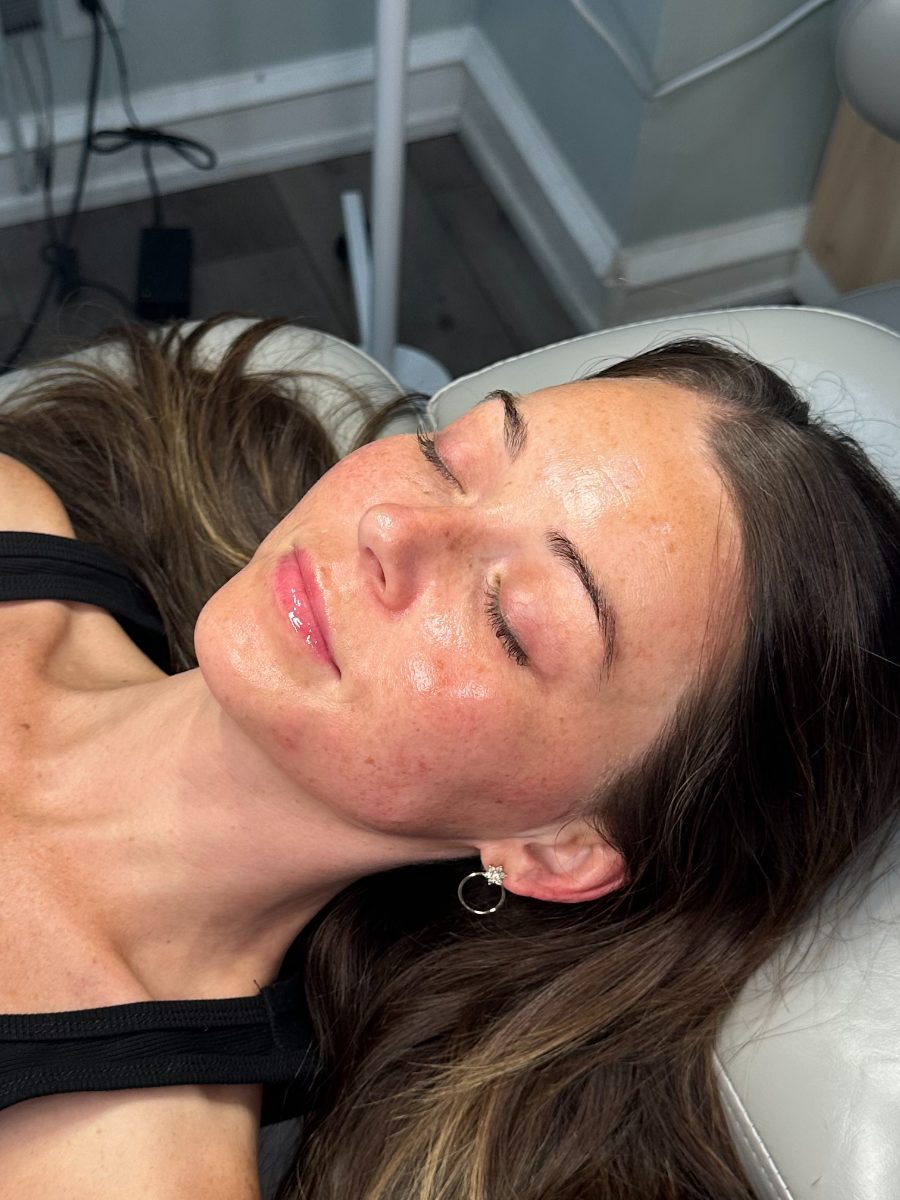 After a Reset Facial
