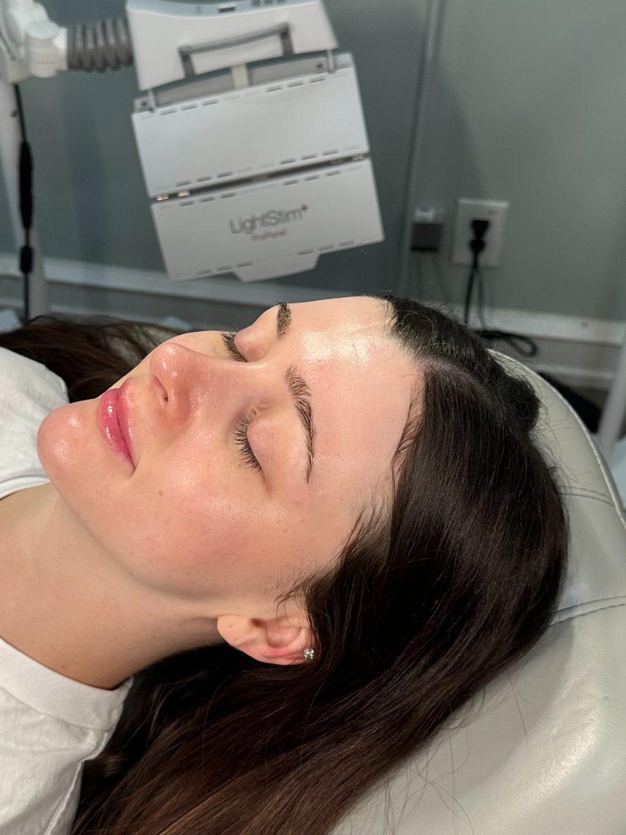 After a Reset Facial