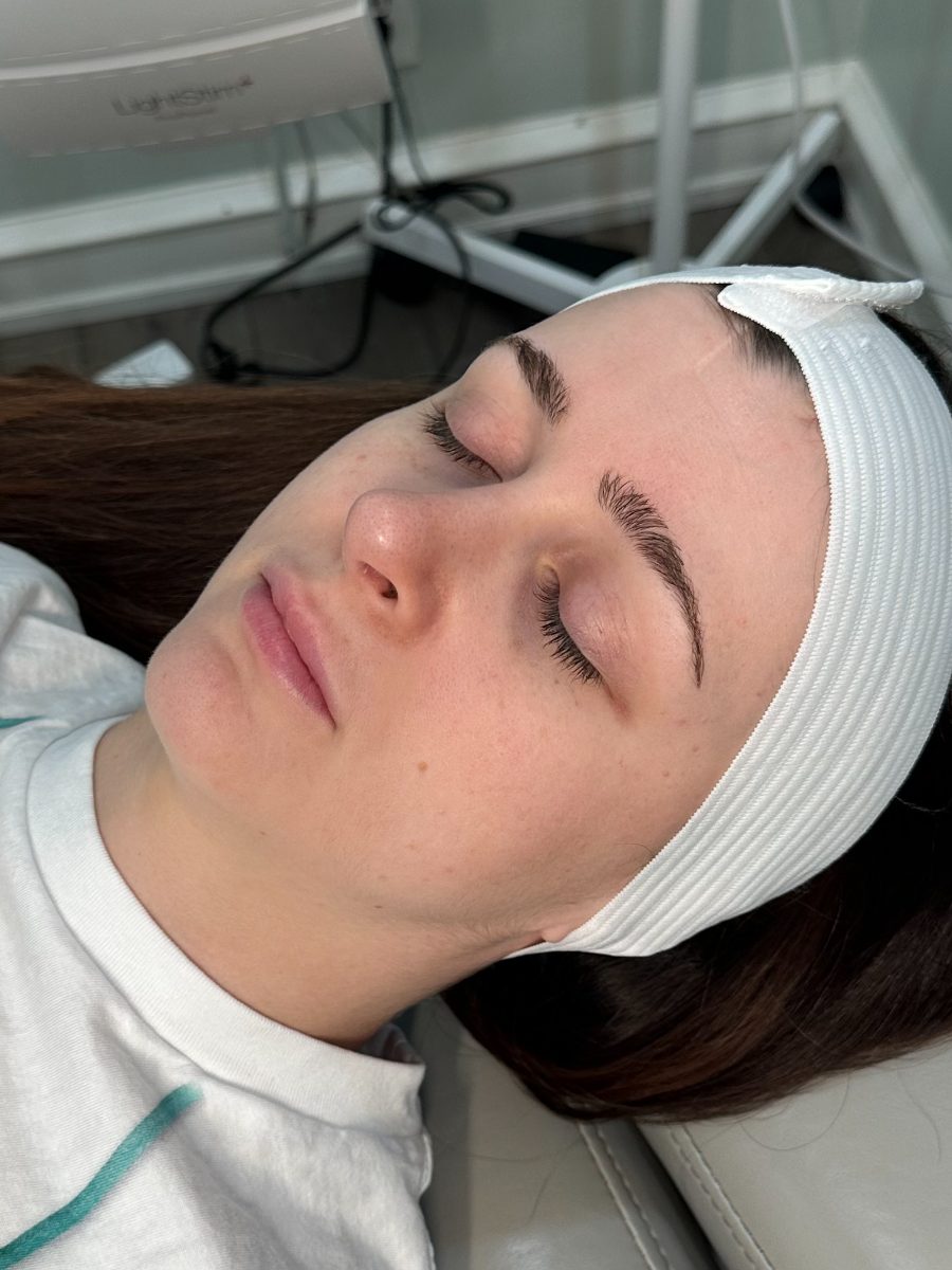 Before a Reset Facial