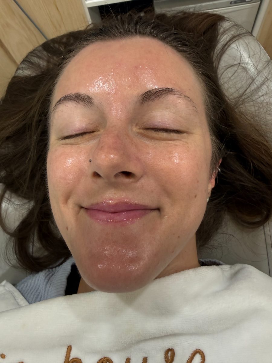 After a Reset Facial
