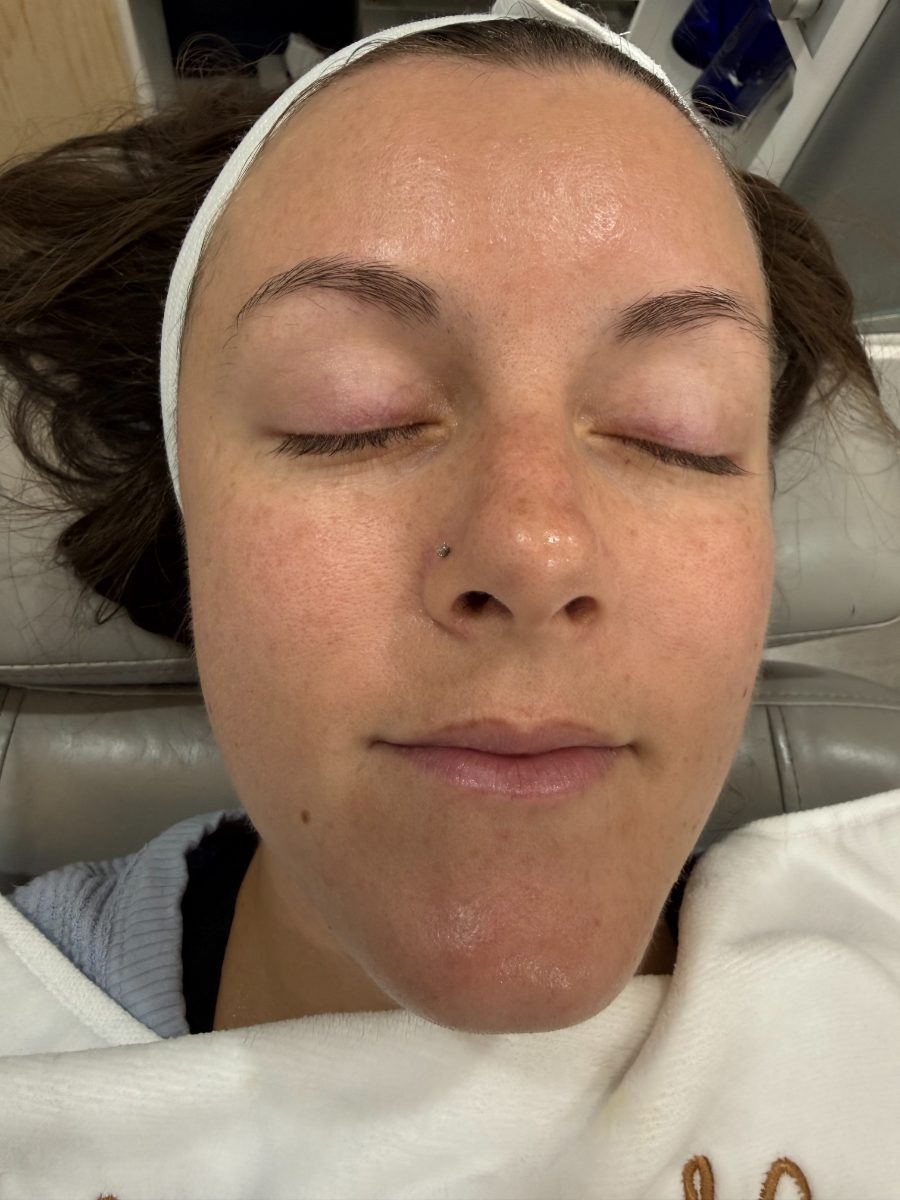 Before a Reset Facial